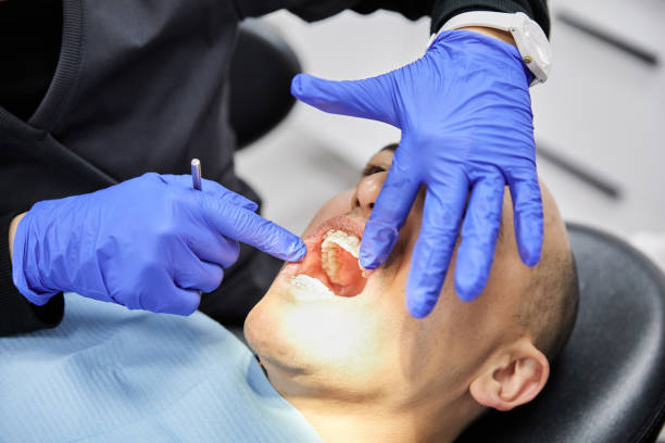 Best Emergency Dental Care for Sports Injuries in Florham Park, NJ